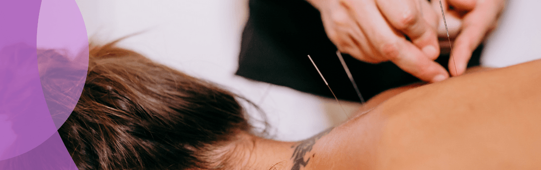 is-acupuncture-covered-by-insurance-a-comprehensive-guide